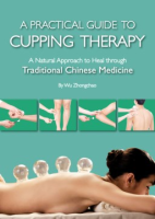 A_practical_guide_to_cupping_therapy