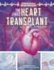 The_first_heart_transplant